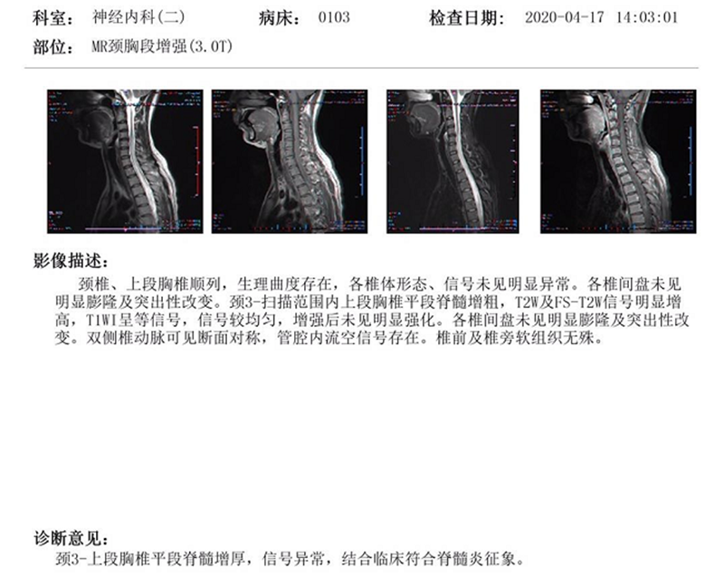 11.3治疗前.png