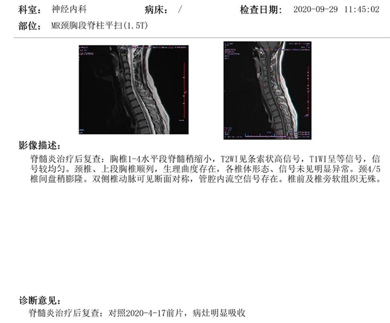 11.3治疗后.png