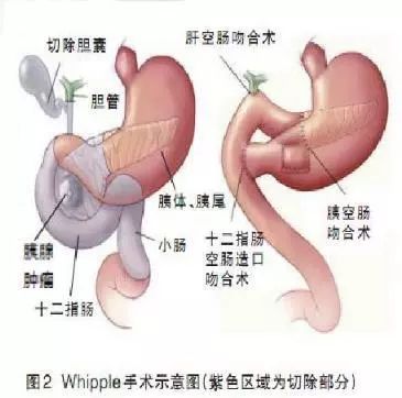 C:\Users\Administrator\Desktop\微信\肠\5.jpg